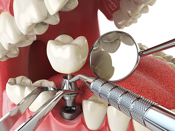 Best Emergency Tooth Extraction  in Wintersville, OH