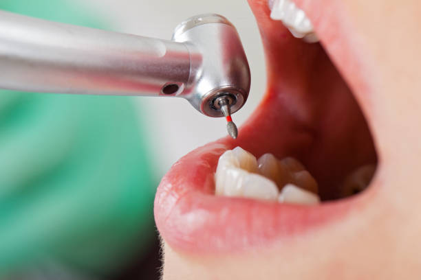 Emergency Dentist Open Today in OH